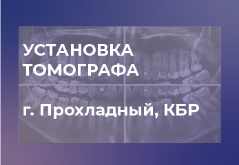 Монтаж и настройка 3D-томографа NewTom Giano 13x16 Монтаж и настройка 3D-томографа NewTom Giano 13x16
